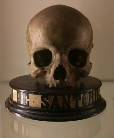 dept1_Hollerbach_Sanctorius_skull.