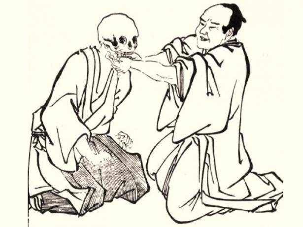 Setting a dislocated jaw. From Kako Ranshū, Sekkō yōketsu (1810).