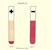 Wasserman Test 