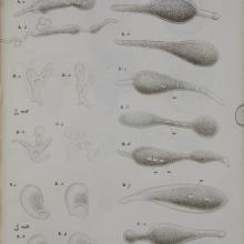 The plate shows motion of the amoeba through the shifting of internal substance 