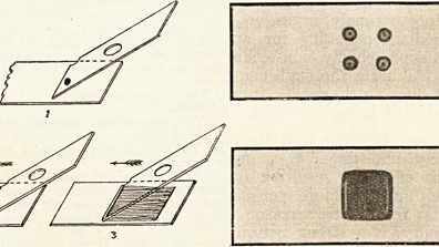 Illustrations of the preparations for thin (left) and thick blood films (right) used in microscopic malaria diagnosis. The author recommends to use both techniques in a comparative manner for reaching a solid diagnosis. In R. Knowles, “The Laboratory Diagnosis of Malaria,” The Indian Medical Gazette 66, no. 5 (May 1931): 272. 
