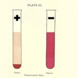 Wasserman Test 